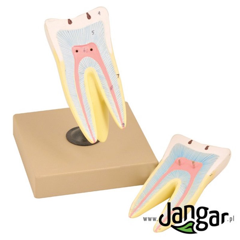 Model of a molar tooth with caries, 10x, 2x.
