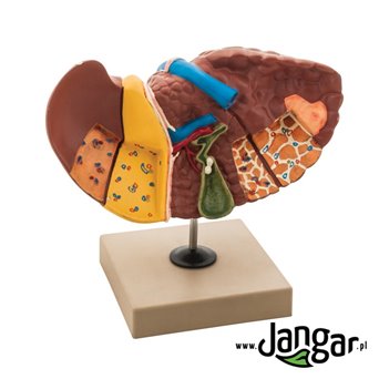 Pathologies Liver Model