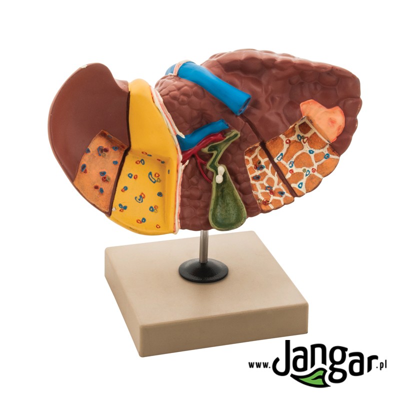 Pathologies Liver Model