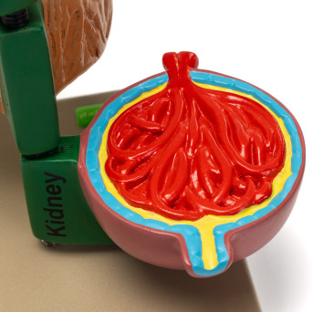 Diabetes-related Anatomy Model, 4-Part