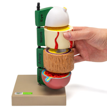 Diabetes-related Anatomy Model, 4-Part