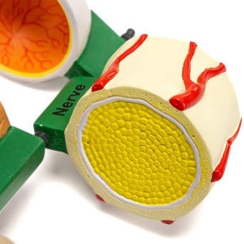 Diabetes-related Anatomy Model, 4-Part