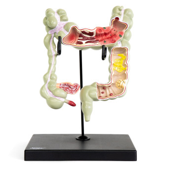 Human Large Intestine Model